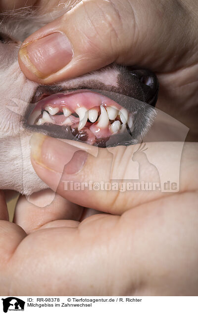 Milchgebiss im Zahnwechsel / milk teeth / RR-98378