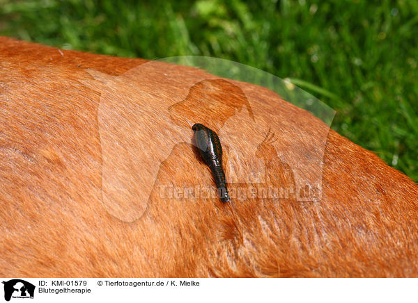 Blutegeltherapie / leech therapy / KMI-01579